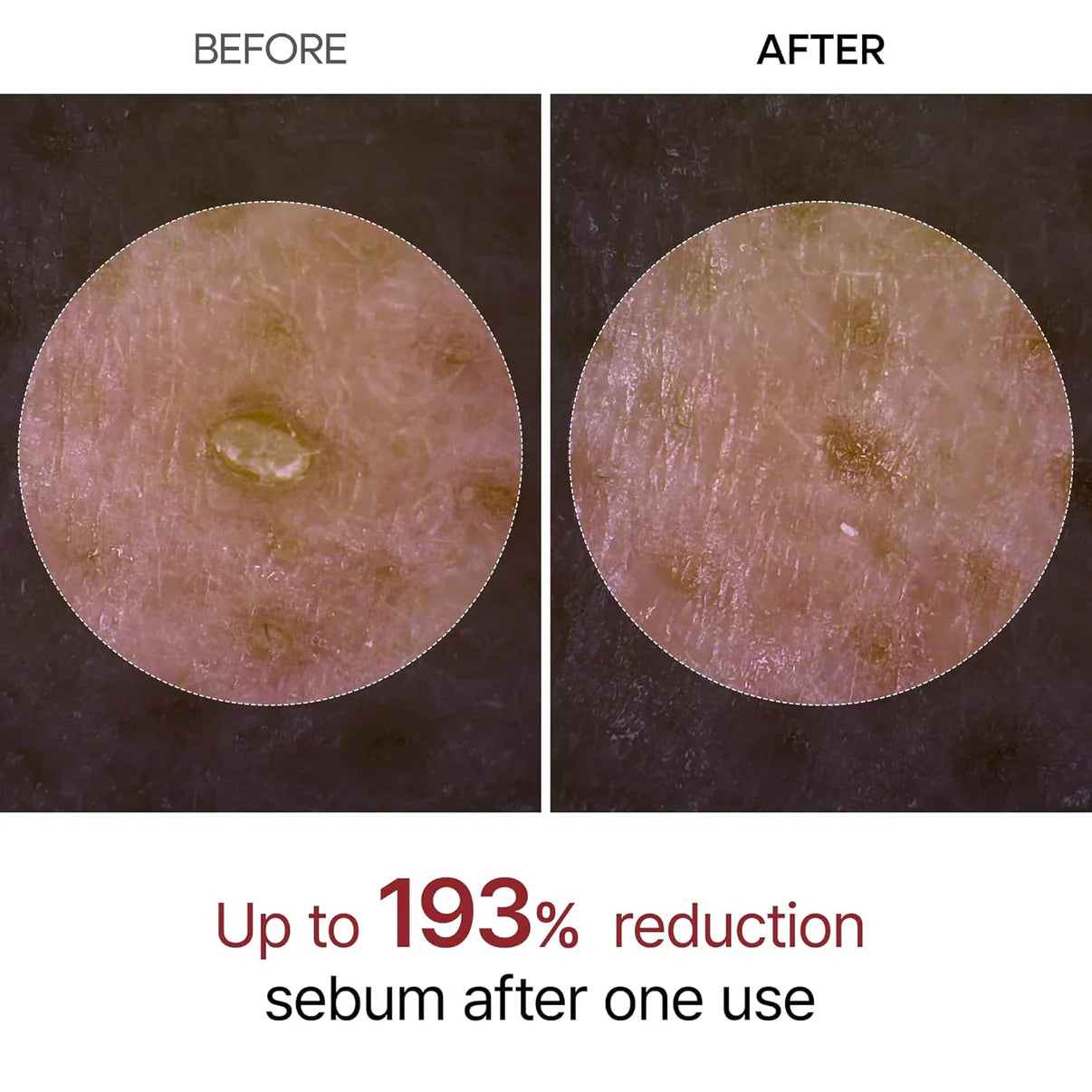 Korean Peel Shot Serum