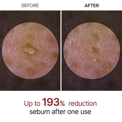 Korean Peel Shot Serum